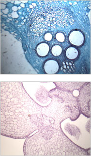 ◆ 写真　顕微鏡の細胞写真 デジタル生物顕微鏡1500HMUで見たカボチャ、ユリ